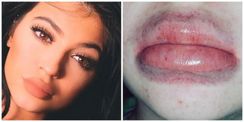 lips2